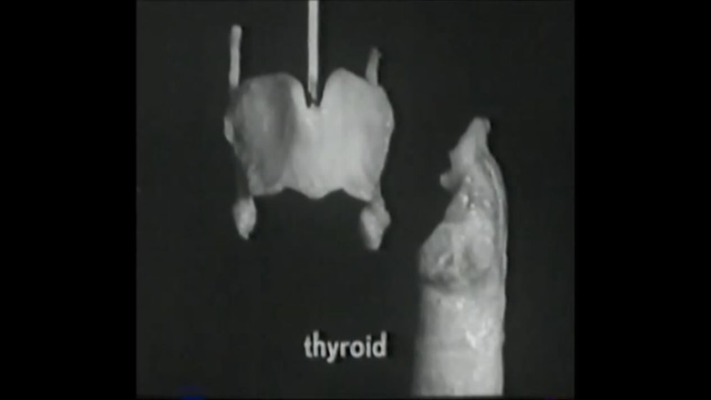 Voice Production: The Vibrating Larynx still 1