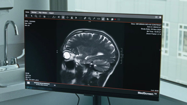 Reversion still 3