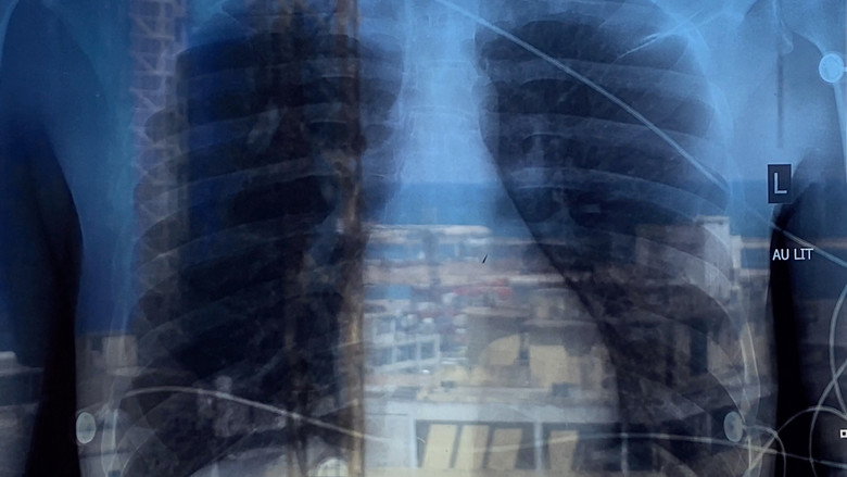 Recovery still 2